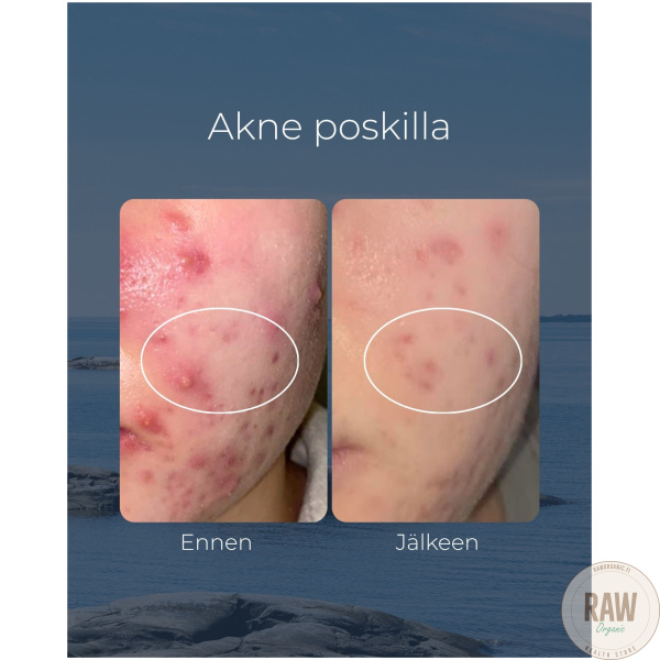 Saaren Taika Teepuusaippua, 90g – kuva 6