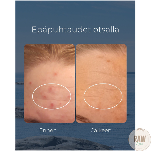 Saaren Taika Teepuusaippua, 90g – kuva 7