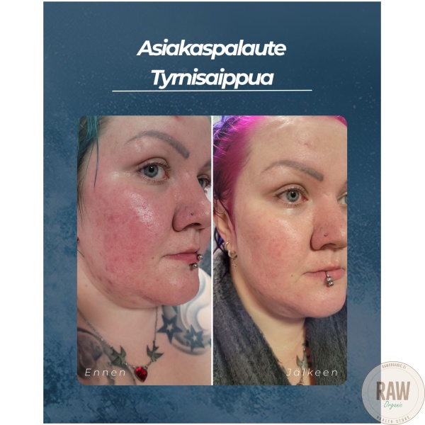 Saaren Taika Tyrni palasaippua, 90g – kuva 5